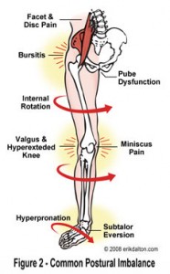 Hyper-Pronation affects pelvis with anterior tilt