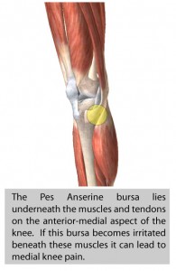 pes-anserine-bursitis