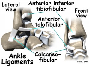 Anterior Inferior Tibiofibular Ligament