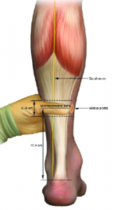 Example of  surgical zone