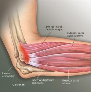 Lateral Epicondyle tendons